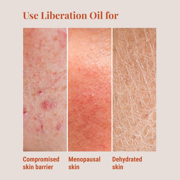 Daily vulva oil for vaginal dryness